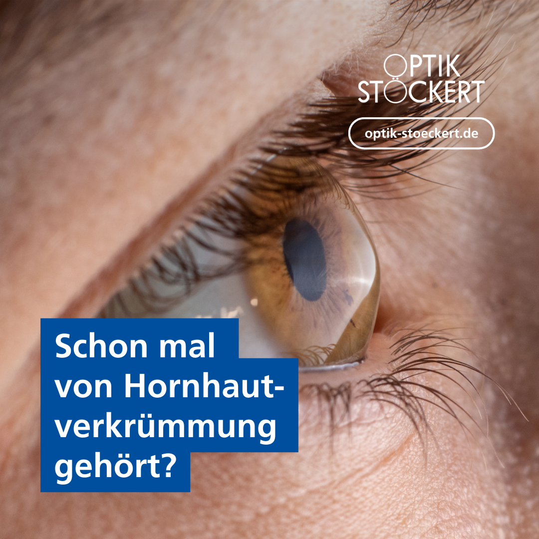 BIld eines Auges mit der Aufschrift "Schon mal von Hornhautverkrümmung gehört?"